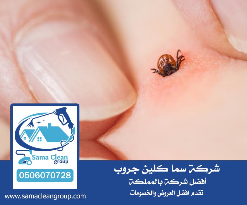 شركة مكافحة القراد بجدة 5 شركة مكافحة القراد بجدة